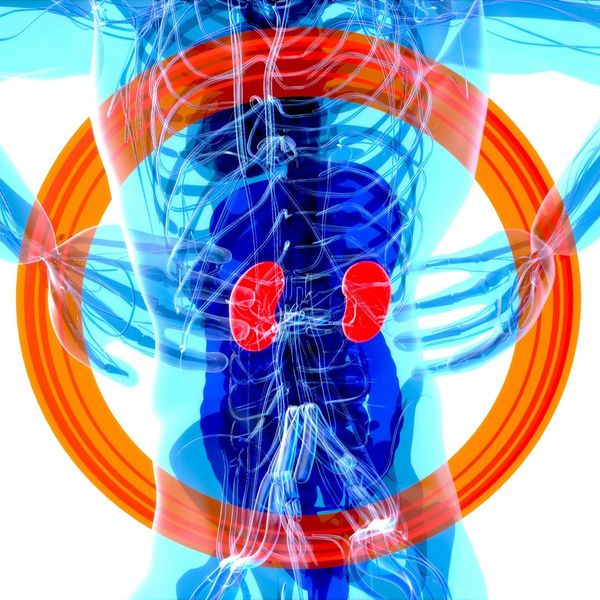 kidney disease plastics